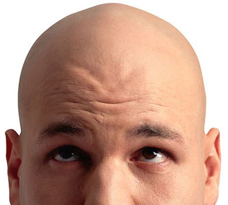 frenar la alopecia